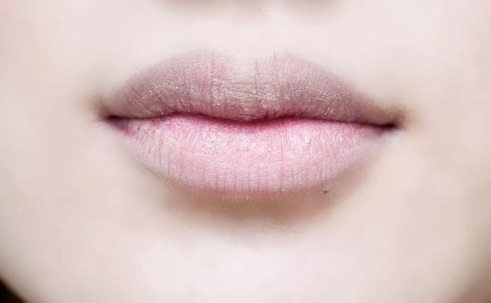 厚唇改薄多久完全恢復(fù)？