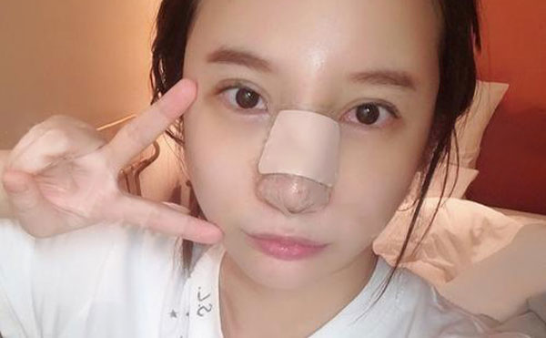 什么情況下需要取出隆鼻假體?取出后鼻子會(huì)變形嗎?