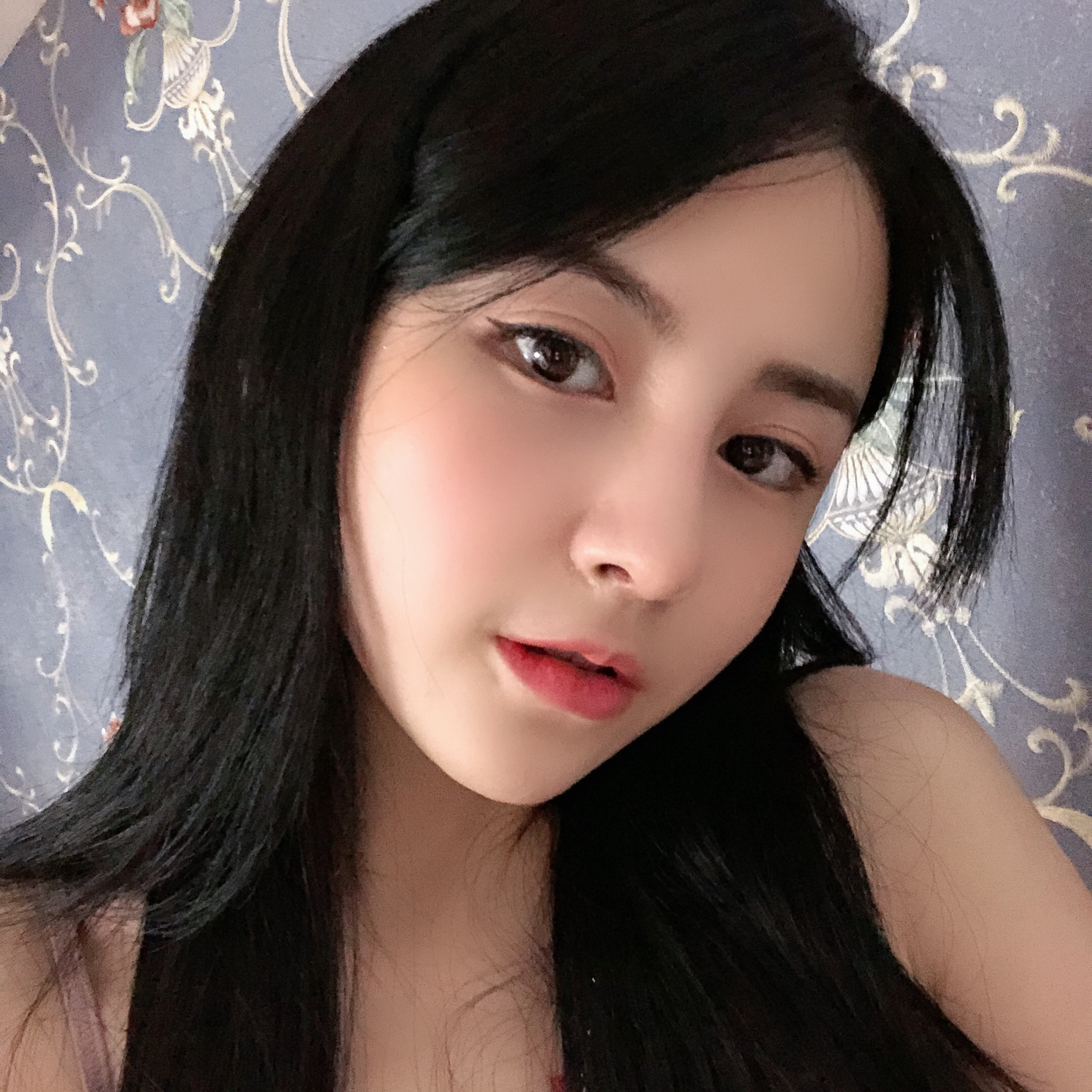 隆鼻手術(shù)術(shù)后效果2