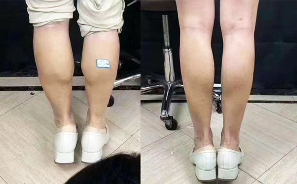 boxo瘦腿好嗎？