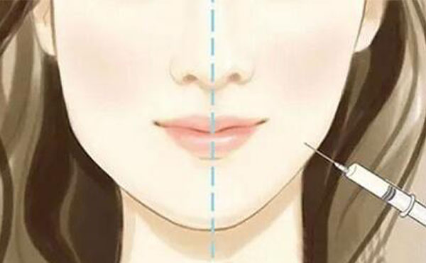 瘦臉針可能會出現(xiàn)什么風險？