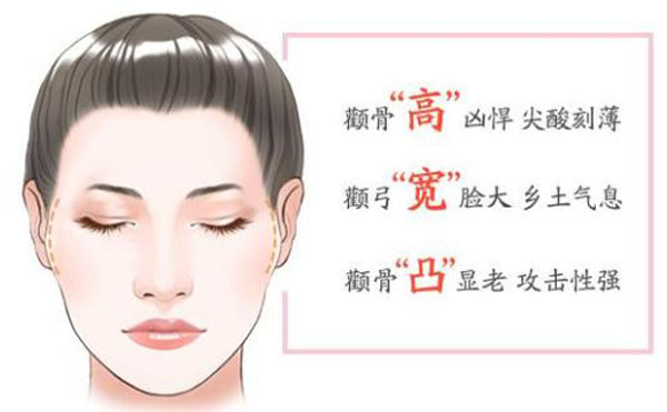 顴骨內(nèi)推整形適宜人群？