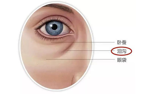 眼袋和臥蠶有什么區(qū)別?去眼袋會(huì)影響臥蠶嗎?