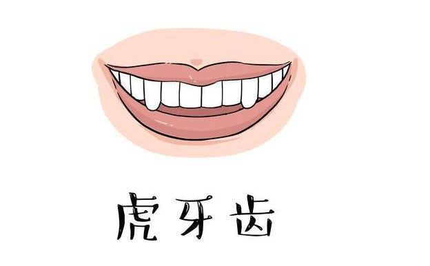 虎牙矯正需要多久？