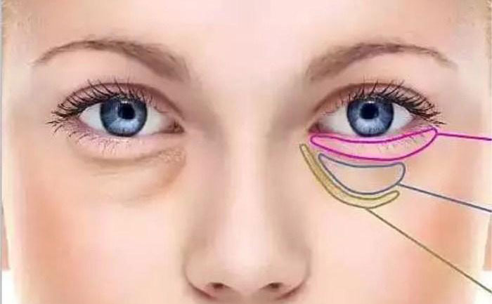 臥蠶跟眼袋怎么區(qū)分？臥蠶和眼袋有什么區(qū)別？