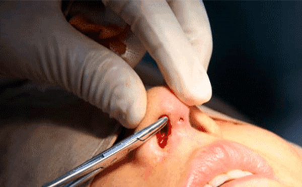 在原來(lái)的假體上，可不可以重新調(diào)整或者更換一下?