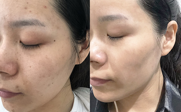 白瓷娃娃疼嗎？