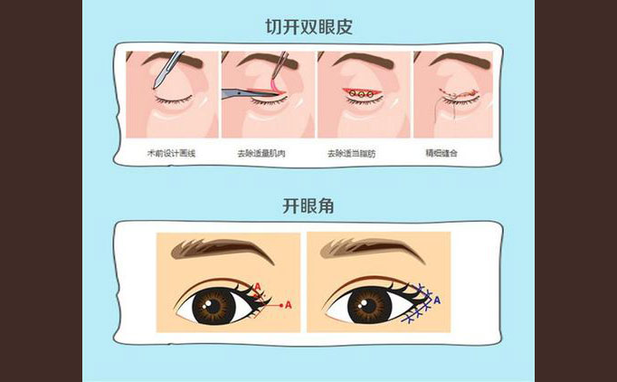 眼部修復(fù)手術(shù)包括什么項(xiàng)目？