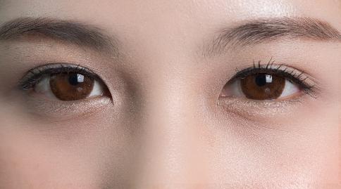 上眼皮松弛是什么原因引起的？