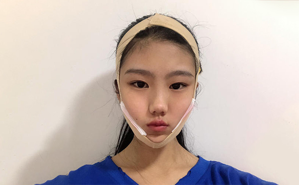 想要確保下頜角整形手術(shù)順利和術(shù)后效果，術(shù)前應(yīng)該做哪些攻略?