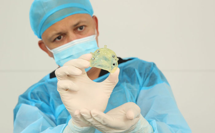 貴金屬烤瓷牙有哪些？貴金屬烤瓷牙的種類