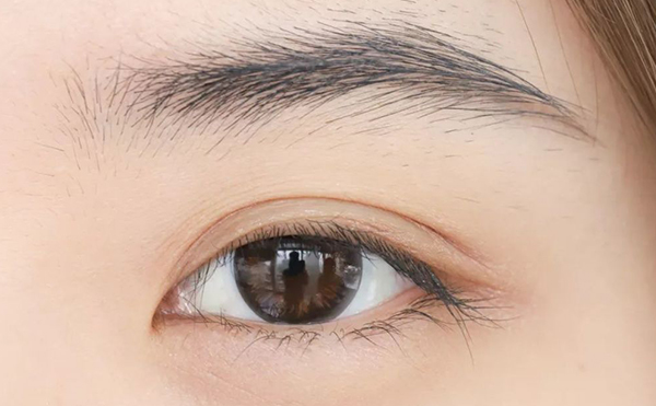 如何判斷單眼皮和內(nèi)雙?單眼皮和內(nèi)雙怎么變成雙眼皮?