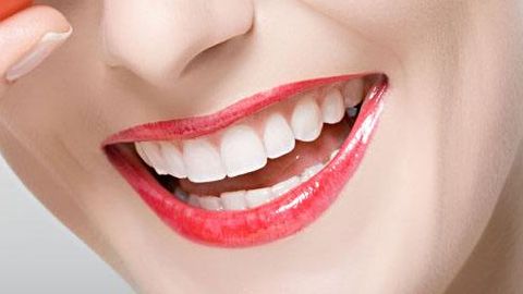 隱形牙套矯正要多久？