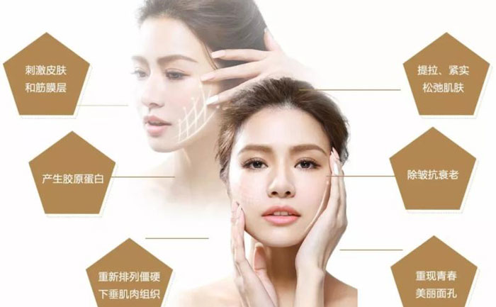 微整形面部提升價格多少？微整形面部提升能保持多久？