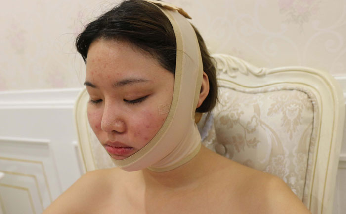 面部吸脂修復(fù)手術(shù)多少錢？面部吸脂會反彈嗎？