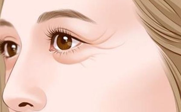 激光去眼袋和手術(shù)去眼袋哪個(gè)好?有什么優(yōu)勢(shì)?