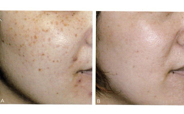 復合彩光效果怎么樣？