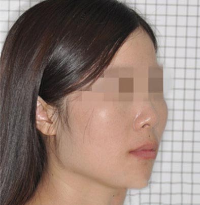 科技發(fā)達人人都可以矯正