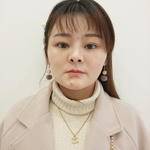 鼻基底整形案例對(duì)比2