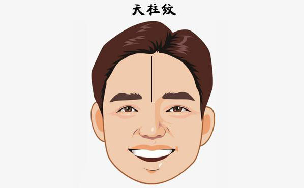 硅膠填充額頭安全嗎？