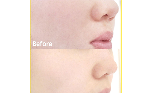 無針?biāo)忉樣懈弊饔脝幔? data-mce-src=