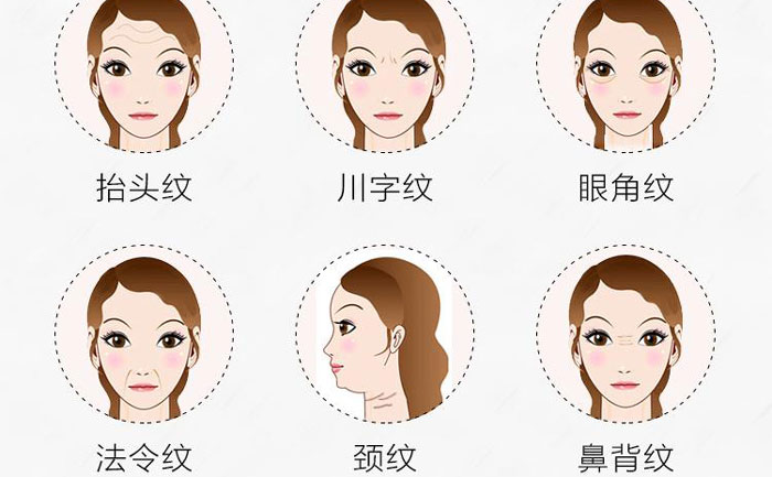 botox除皺針有哪些副作用？