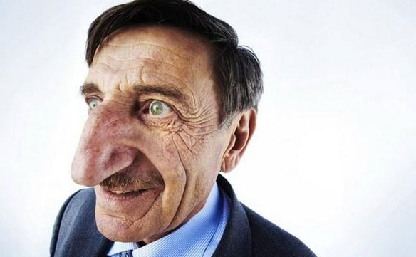 大鼻頭如何變??？鼻頭大怎么改善？