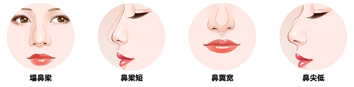 各種鼻型