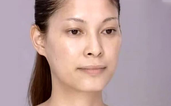 改臉型手術(shù)會不會有后遺癥?安全嗎?