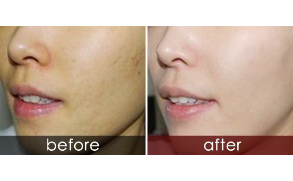 白瓷娃娃適合人群有哪些？