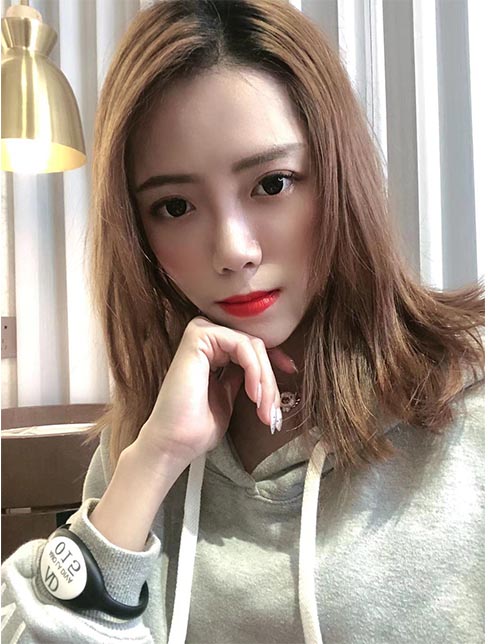 肋軟骨鼻綜合案例：術(shù)后效果2