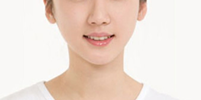 面部吸脂術(shù)后