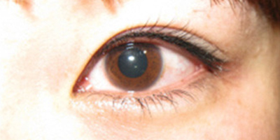 半永久紋眼線術后