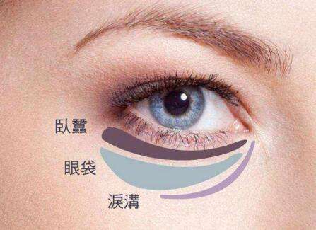 眼袋失敗修復(fù)要怎么處理？切眼袋需要多長(zhǎng)時(shí)間恢復(fù)？