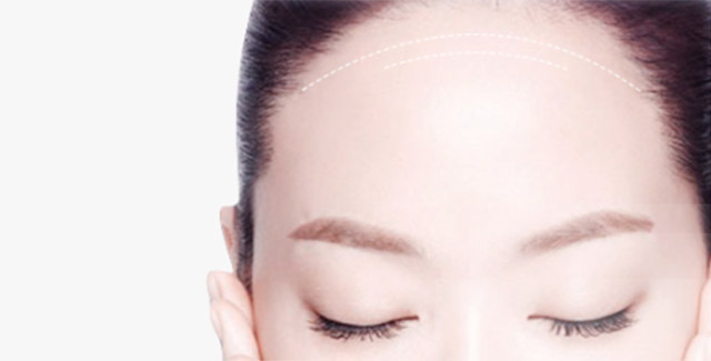 自體脂肪豐額頭效果怎么樣？自體脂肪豐額頭效果可以保持多久？