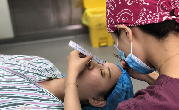 超體隆鼻怎么樣，能保持多久？超體隆鼻可能出現(xiàn)的副作用有哪些？