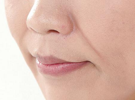 注射填充法令紋的方式有哪些？如何通過(guò)醫(yī)美手段祛法令紋？