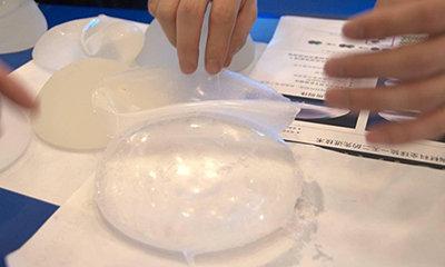 假體隆胸多少錢大概？假體隆胸多久能變軟？