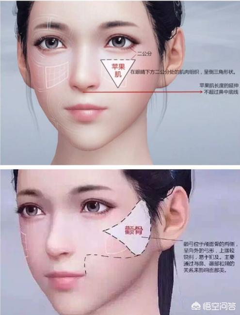 玻尿酸填充蘋果肌后效果能保持多久？想豐蘋果肌是自體好一點還是玻尿酸好一點？