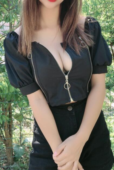 上海德琳醫(yī)療美容醫(yī)院假體隆胸手術(shù)幾天后的情況