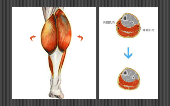 小腿肌肉阻斷術(shù)是什么？小腿神經(jīng)阻斷術(shù)的后遺癥有嗎？