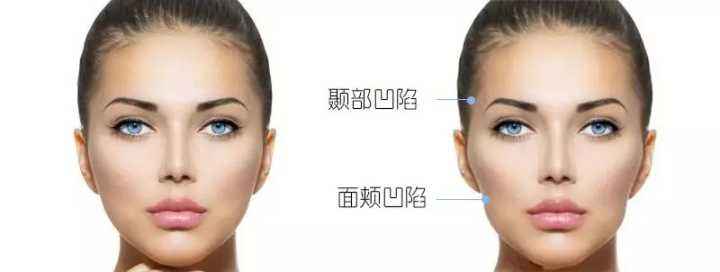 熱瑪吉做一次可以保持多久？熱瑪吉的原理和功效