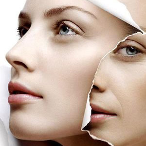 OPT嫩膚有什么功效  OPT嫩膚需要注意的事項