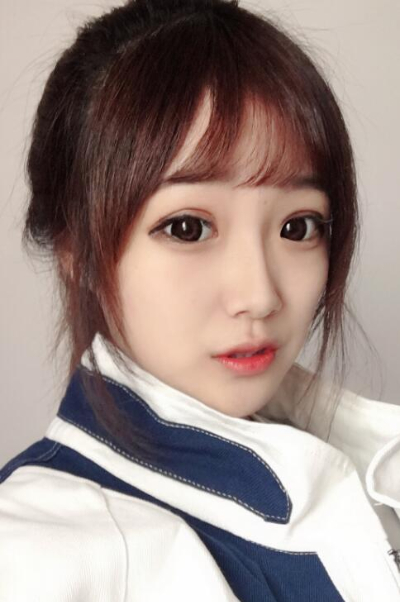 蘇州愛思特醫(yī)療美容醫(yī)院做隆鼻手術(shù)后的鼻子狀態(tài)