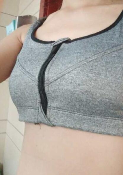 上海美萊醫(yī)療美容門(mén)診部做隆胸手術(shù)后一個(gè)月的情況