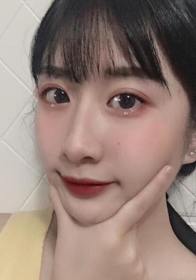 珠海陸達(dá)美容外科醫(yī)院做下頜角后完成小臉的蛻變