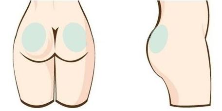 成都大華韓藝做臀部吸脂減肥安全性如何有什么特點(diǎn)？