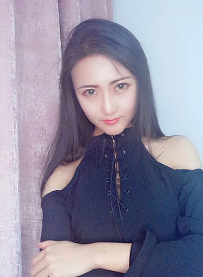 上海時(shí)光整形外科醫(yī)院王濤做顴骨整形案例效果分享