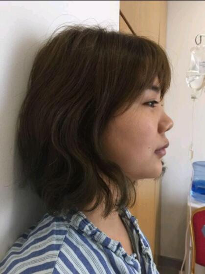 上海美萊醫(yī)療美容門診部做鼻綜合手術前