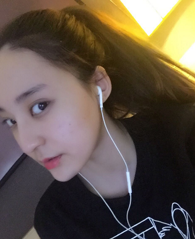 北京京民醫(yī)院（原釣魚臺(tái)醫(yī)院）整形外科郭建玲下頜骨案例效果分享